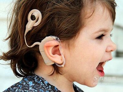 成人听损要不要植入人工耳蜗？