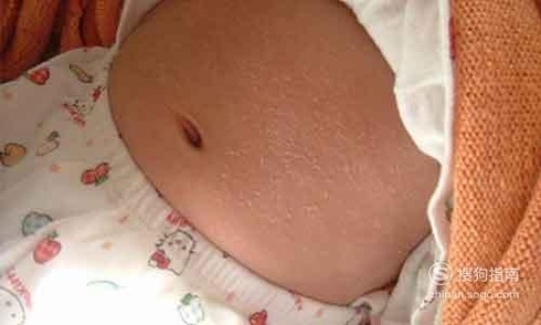 宝宝干性湿疹怎么护理